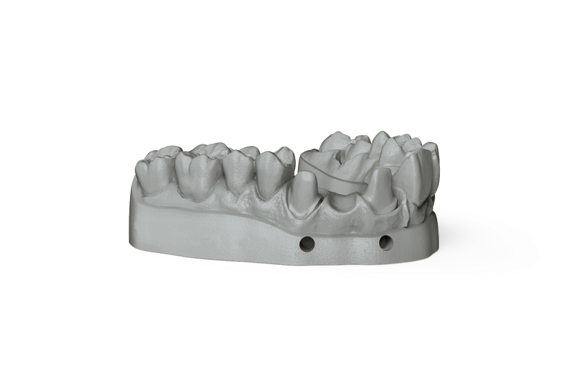 Фотополимер NextDent Model 2.0, оттенок Grey (серый). Упаковка 1000 гр., арт: NDM2GR01000