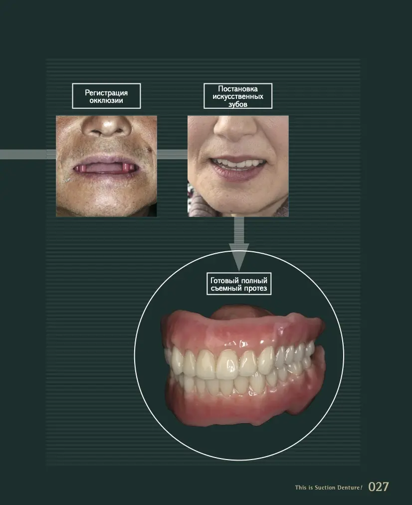 Это присасывающийся протез! Автор: Кацуси Сато