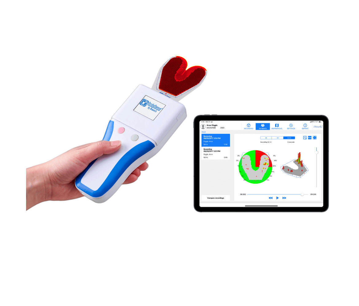 Bausch OccluSense - система для диагностики окклюзии