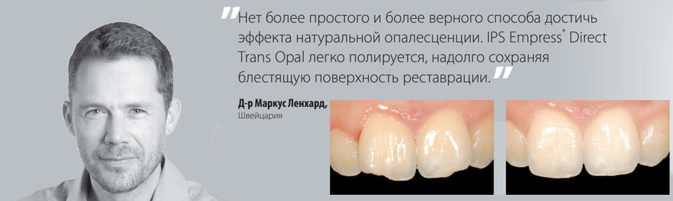 Композит IPS Empress Direct Refill Композит Импресс Дайрект Рефилл