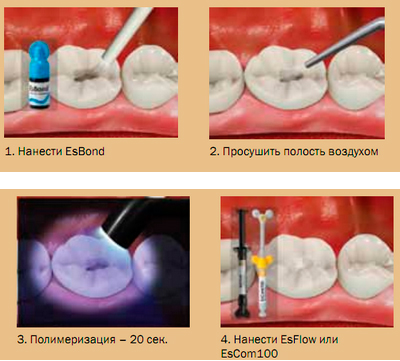 Эс бонд адгезив