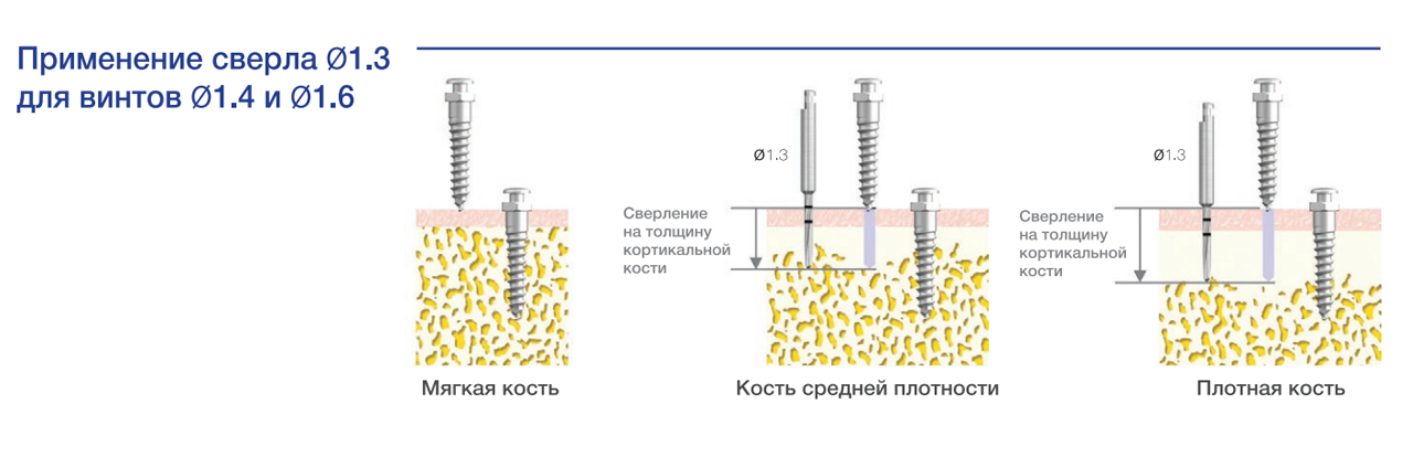 ortosv_13