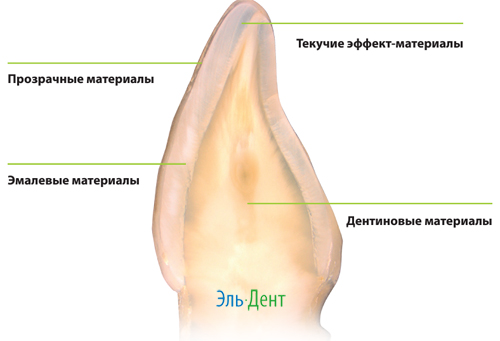 Композит Импресс Дайрект Рефилл