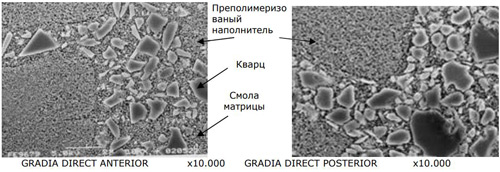 Световые композиты Gradia Direct - ЭльДент