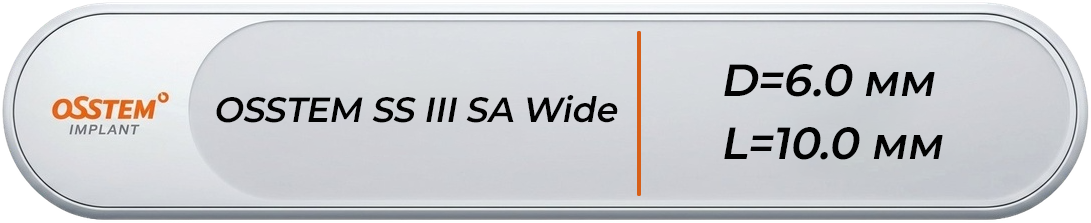 ASS3W6010S20