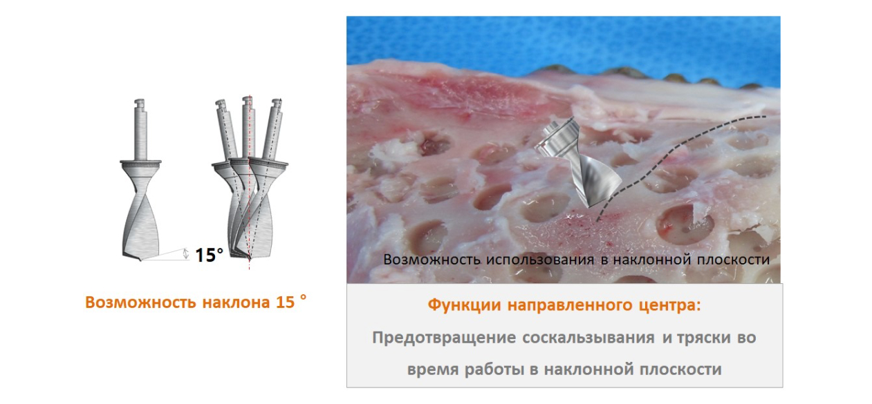 cверло для забора аутокости-4-2