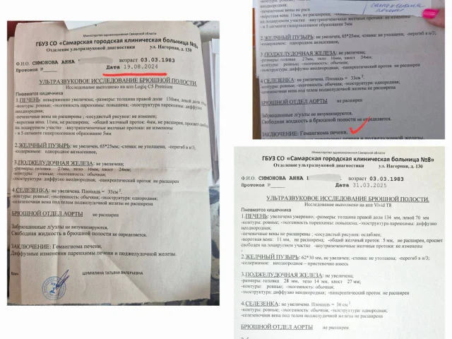 Фото: Исчезла гемангиома печени после обработки домашним физиотерапевтическим прибором - активатором!
