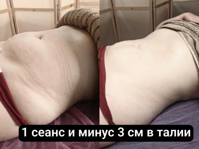 Фото: Устали худеть и обратно набирать вес?