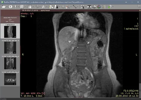 Скриншот №1 к программе RadiAnt DICOM Viewer