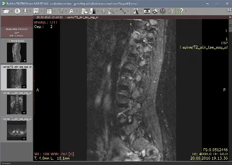 Скриншот №2 к программе RadiAnt DICOM Viewer