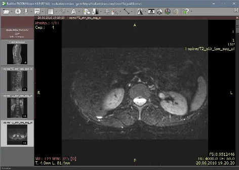 Скриншот №3 к программе RadiAnt DICOM Viewer