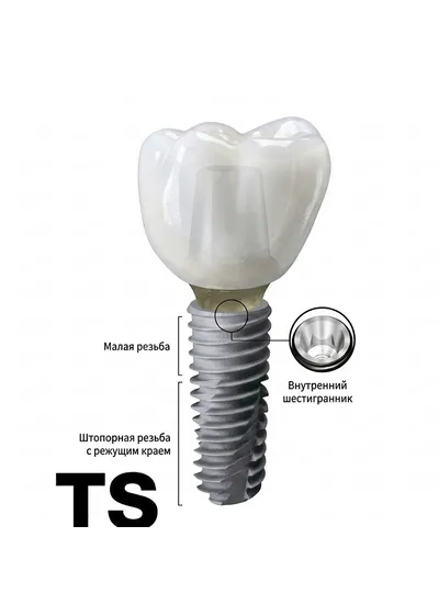 Имплантат, Osstem, TS III SA Standart, D=4.0 мм, L=7.0 мм, без адаптера и винт-заглушки