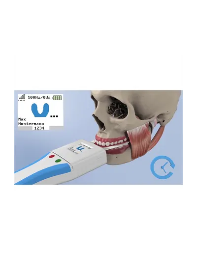 Bausch OccluSense - система для диагностики окклюзии