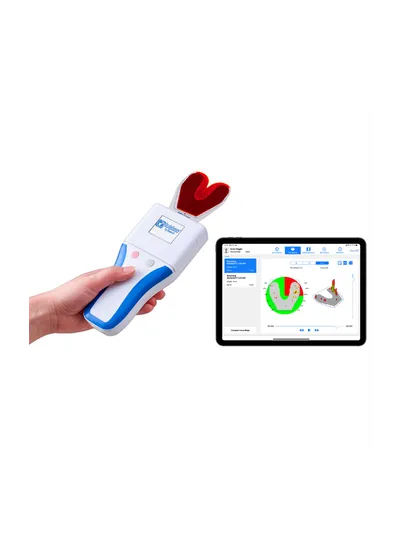 Bausch OccluSense - система для диагностики окклюзии