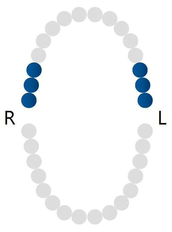 Кламп для "раббердама" Rubber Dam Clamp W8A, Dentech Corporation