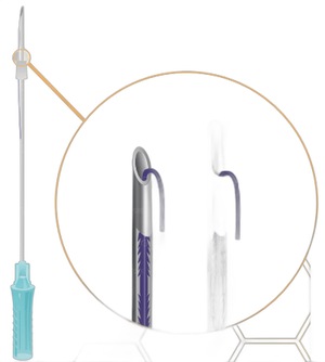 Мезонити Honey Derma Thread PDO COG 2R (FC type) 19Gx100mm - 170mm (Хани Дерма Фред)