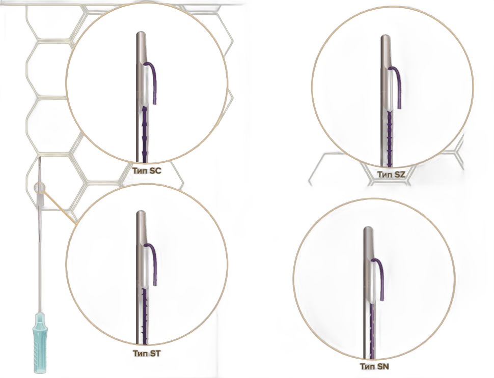 Мезонити Honey Derma Thread PDO DUAL NEEDLE SC type 21Gx110mm - 404mm (Хани Дерма Фред)