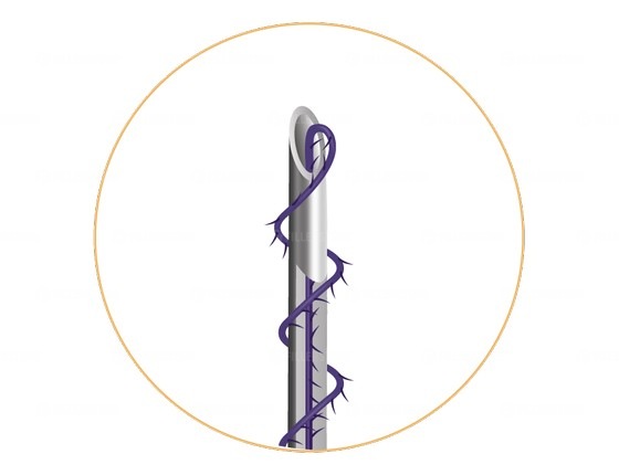 Мезонити Honey Derma Thread PDO COGGING SCREW+DSP type 25Gx60mm - 185mm (Хани Дерма Фред)