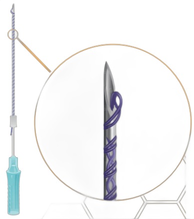Мезонити Honey Derma Thread PDO DOUBLE SCREW 26Gx50mm - 80mm (Хани Дерма Фред)